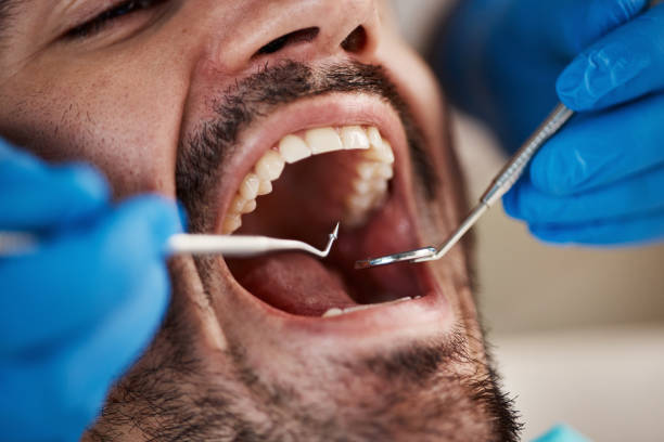 Best Emergency Treatment for Dental Infections or Abscesses in Orosi, CA
